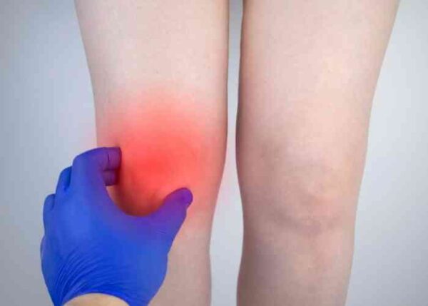 noga boli tibia zajednički liječenje artroze koljena lila